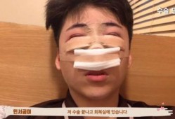 整容网红爆料视频大全最新,最新爆料视频大盘点