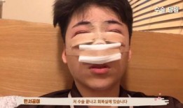 整容网红爆料视频大全最新,最新爆料视频大盘点