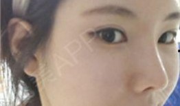 娱乐吃瓜酱不用做鼻子,揭秘明星隐私，不做鼻子也能畅游娱乐圈